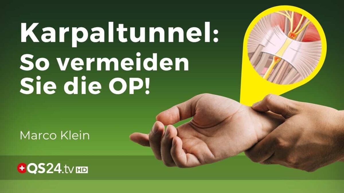 Karpaltunnelsyndrom ohne OP behandeln | Kleinsche Felder | Marco Klein | QS24 Gesundheitsfernsehen