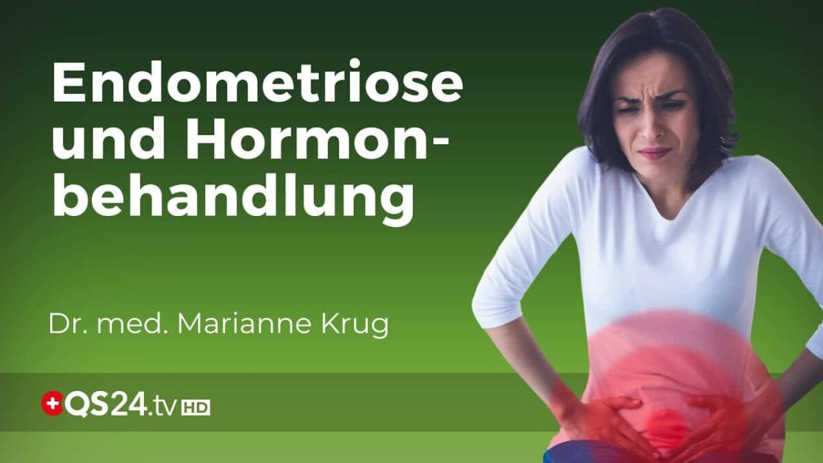 Gynäkologische Herausforderung :  Hormonelle Therapie bei Endometriose | Marianne Krug  | QS24