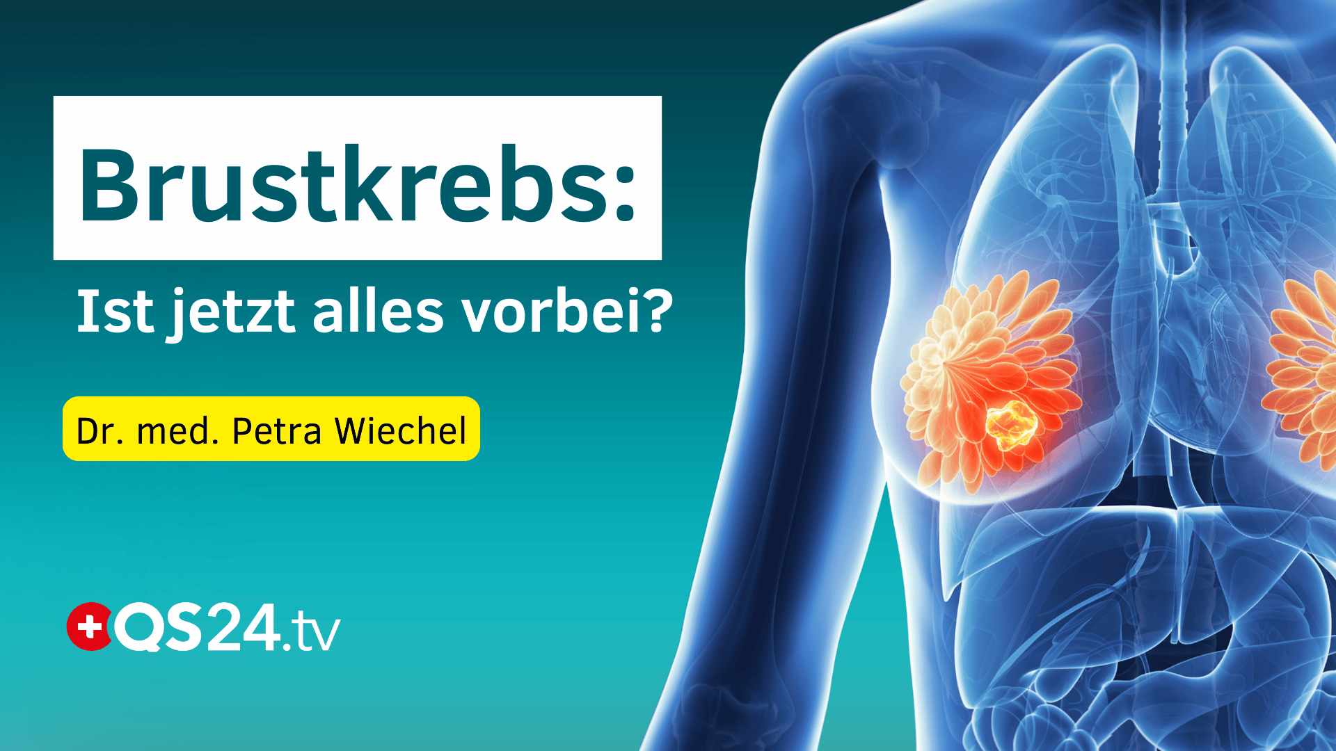 Brustkrebs