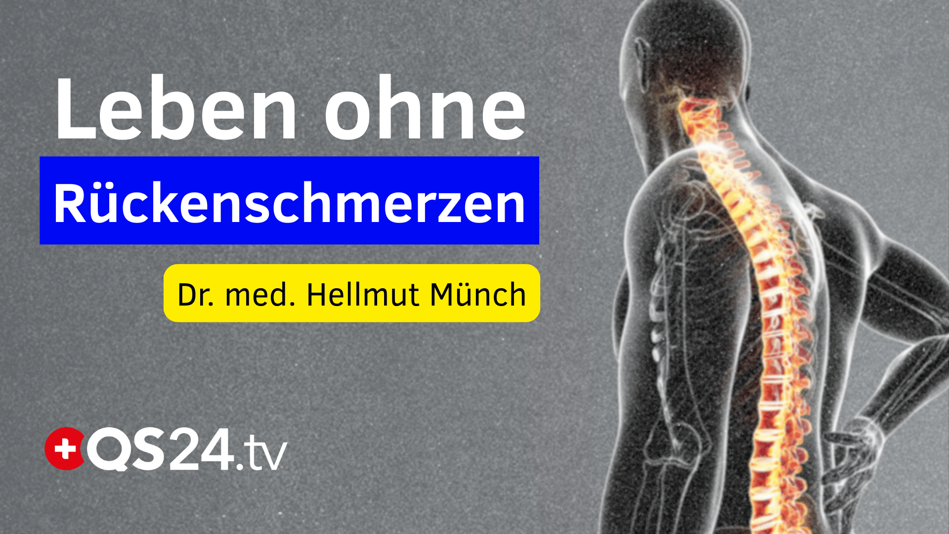 Rückenschmerzen was wirklich langfristig hilft
